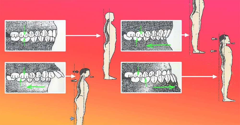 Szczęka i kręgosłup są ze sobą nierozerwalnie połączone, jeśli boli cię plecy, musisz leczyć zęby! /  Choroby