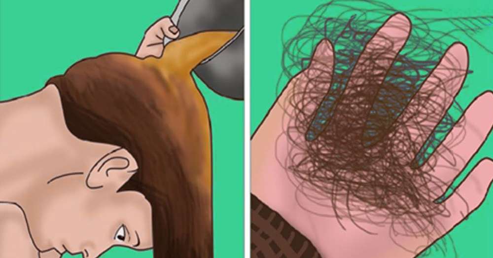 Trzy testy na wypadanie włosów. Konieczne jest ustalenie przyczyn powolnego wypadania włosów. /  Choroby