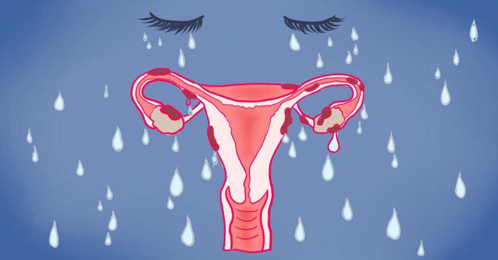 Endometrióza je choroba pracujúcich žien! Vezmite si to a odchádzajte ... /  choroba
