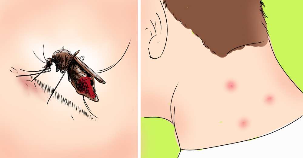 Zbohom, krvi! Prírodné prostriedky pre všadeprítomných komárov, ktoré sú prístupnejšie, aby sa nenašli. /  nápady