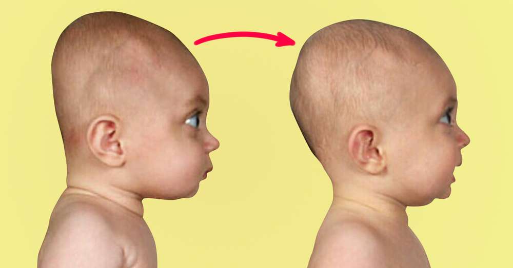 Fatalna pogreška! 4 trikovi će spriječiti flat head sindrom u dojenčadi. /  glava