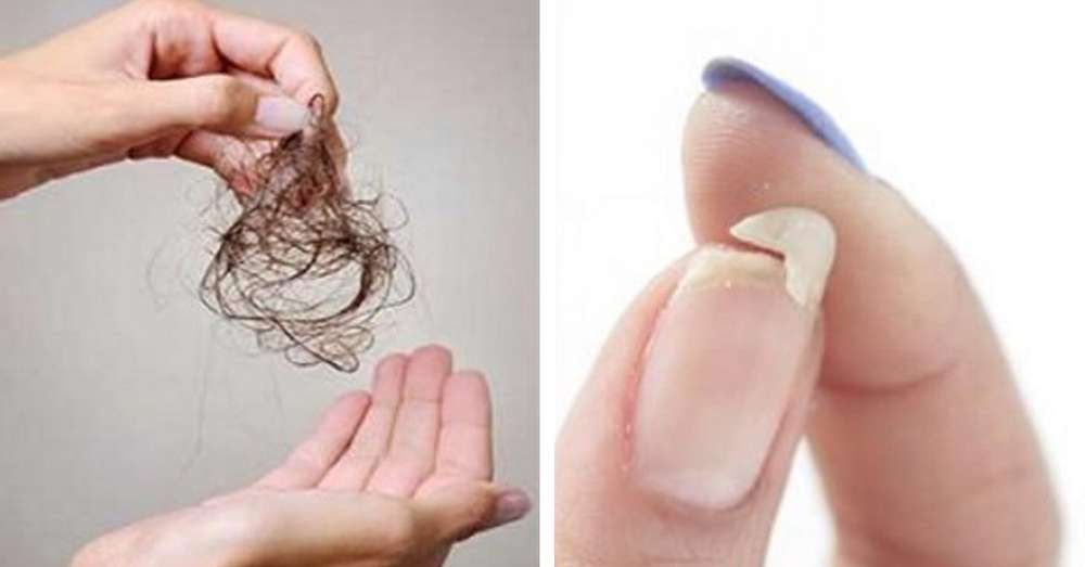 Jeśli martwisz się wypadaniem włosów, łamliwymi paznokciami lub złym snem, to właśnie musisz jeść! /  Włosy