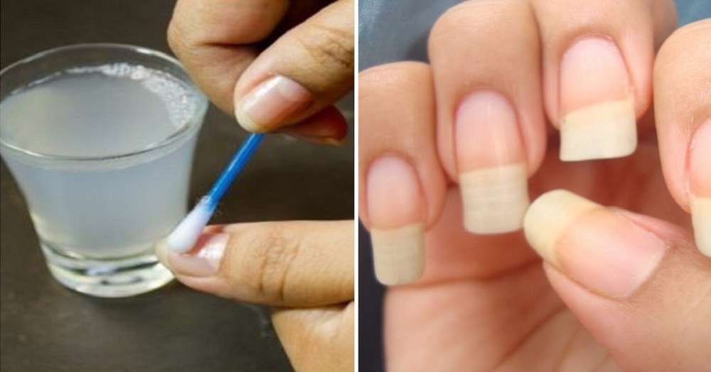 Як швидко відростити нігті, які ніколи не зламаються допоможе простий засіб з 4 компонентів! /  жінки