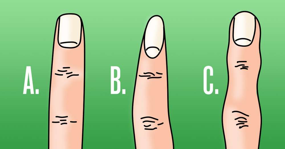 Prečítajte si tvar ruky prstov, ktorý vie veľa o osobe. /  prsty