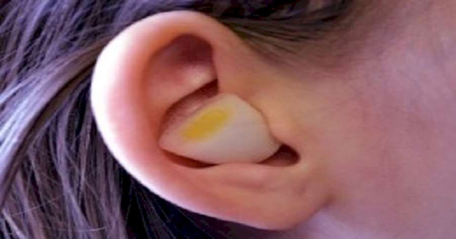 To je to, čo sa stane, ak si do ucha položíte kúsok cibule. Prečo som o tom ešte nevedel? /  koža