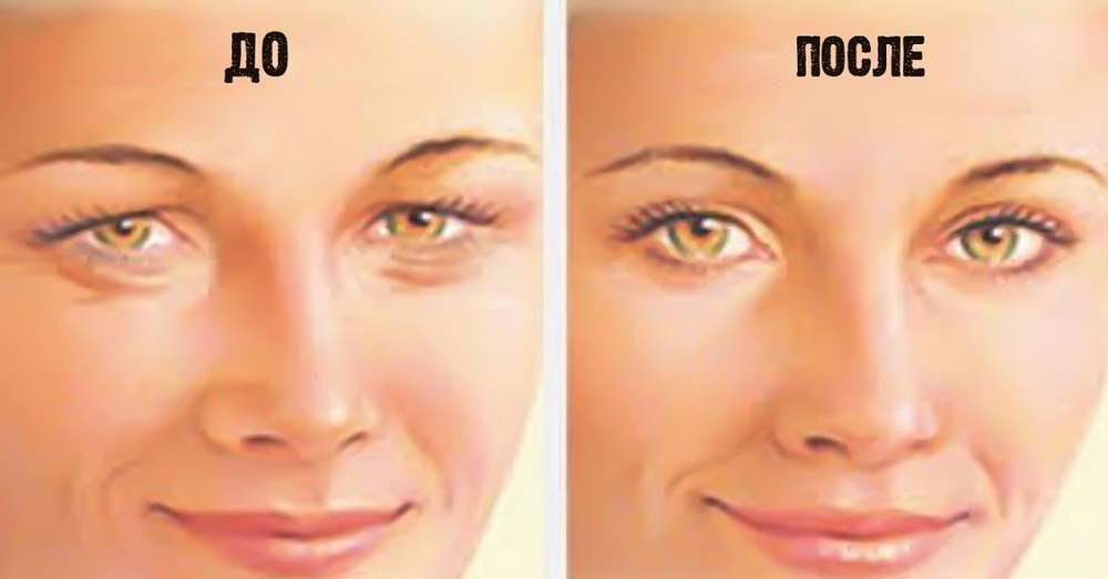 Tu je návod, ako utiahnuť pokožku uviaznutú do očných viečok v 4 jednoduchých krokoch. Už som sa pokúsil! /  oči