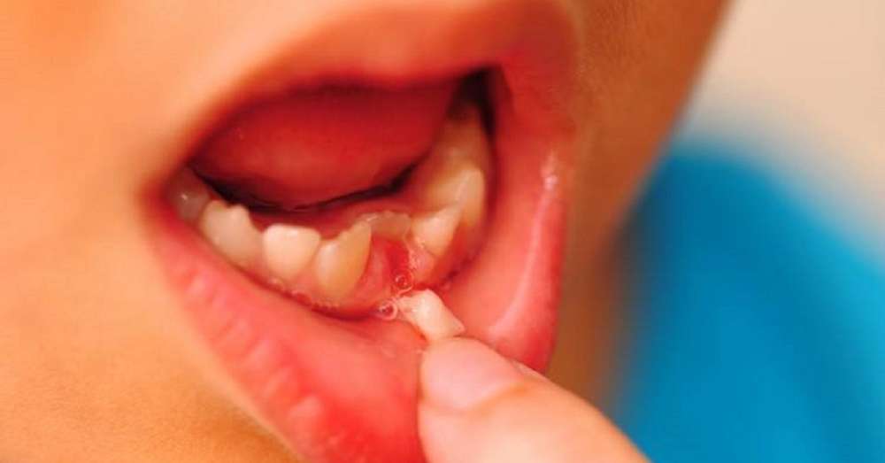 Preto nie je potrebné dať mliečne zuby do víly zubov. Neuveriteľný objav! /  deti