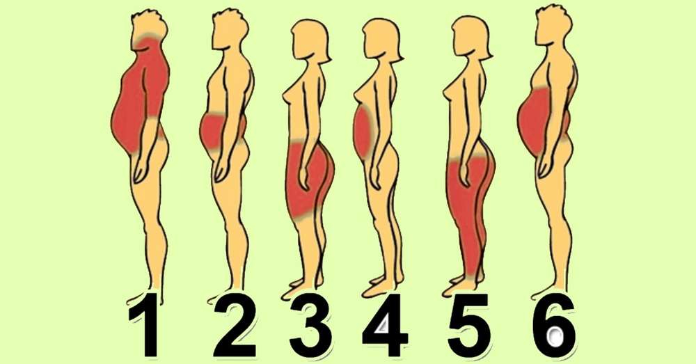 6 типів ожиріння про що говорять зайві сантиметри на твоєму тілі. /  дієта