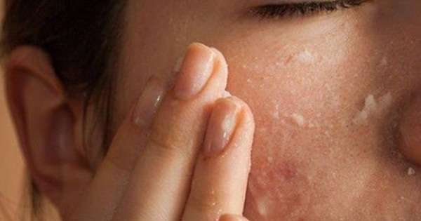 7 enostavnih in učinkovitih načinov čiščenja povečanih pore. Porcelanska koža je zajamčena! /  Veverice