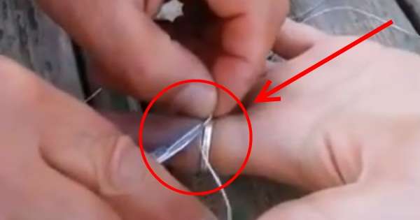 Tento životný hack môže zachrániť váš život! Tu je to, čo robiť, ak je prstenec prilepený na prst ... /  krúžok