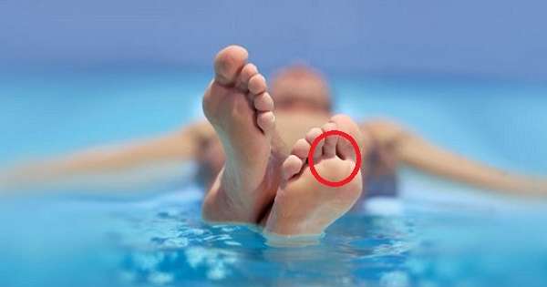 Jak uniknąć infekcji grzybem stopy jest ważne, aby wiedzieć wszystkim, którzy wybierają się na wakacje! /  Higiena