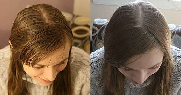 Вона відмовилася від шампуню на цілих 6 місяців. Результат перевершив всі очікування! /  волосся