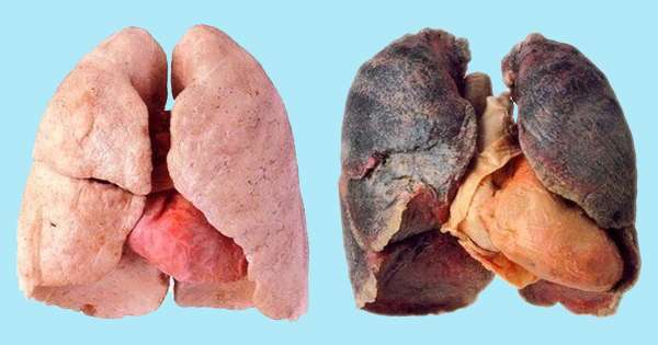Ako čistiť pľúca po fajčení 4 spôsoby, ktoré odstránia toxíny z tela! /  fajčenie